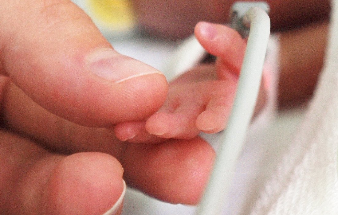 Hand eines frühgeborenen Babys